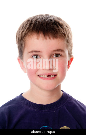 Kleiner Junge mit fehlenden Schneidezahn Stockfoto