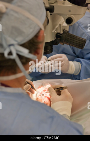 Augenarzt, Katarakt-Operation durchführen Stockfoto
