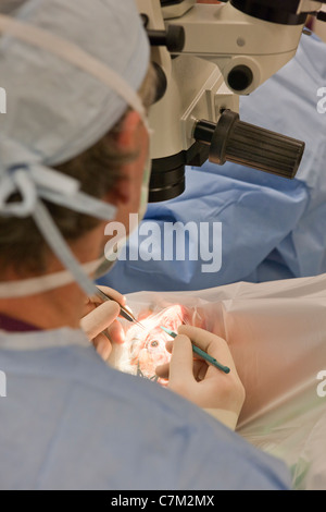 Augenarzt, Katarakt-Operation durchführen Stockfoto