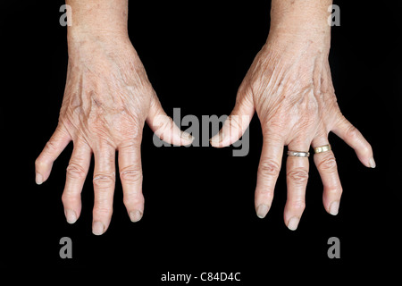 Closeup Aufnahme der offenen Handflächen der alten Frau Stockfoto