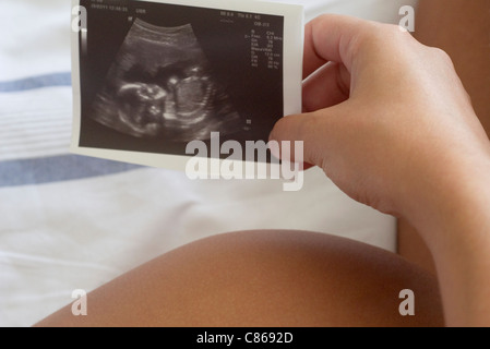 Schwangere Frau mit Ultraschall, beschnitten Stockfoto