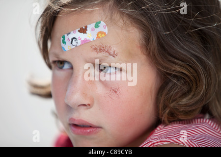 Deutschland, Bayern, Wounded Mädchen sitzen auf der Straße nach Fahrradunfall, Nahaufnahme Stockfoto