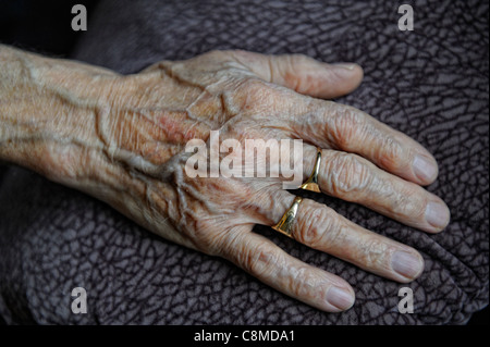 faltige Hände einer 82 Jahre alten männlichen England-Vereinigtes Königreich Stockfoto