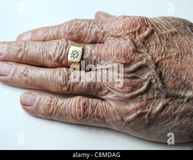 faltige Hände einer 82 Jahre alten männlichen England-Vereinigtes Königreich Stockfoto