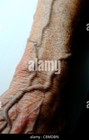 Venen am Arm 82 Jahre alten männlichen England-Vereinigtes Königreich Stockfoto