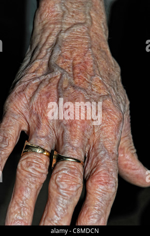 faltige Hände einer 82 Jahre alten männlichen England-Vereinigtes Königreich Stockfoto