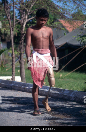 Landminen bleiben das brutale Erbe der Jahre des Krieges in Kambodscha. Stockfoto