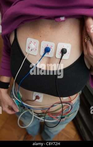 Eine Frau trägt ein Holter, eine ambulante Elektrokardiographie Gerät, überwacht die elektrische Aktivität ihres Herz-Kreislauf-Systems Stockfoto