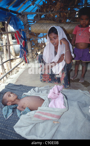 250.000 Rohingya-Flüchtlinge (1/3 der gesamten Pop) aus Arakan Provinz in Birma Regierung Unterdrückung fliehen. Teknaf. Bangladesch. 1992. Stockfoto