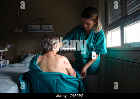 Krankenschwester kümmert sich um Patienten mit Hautkrankheiten in einem Krankenhausbett Stockfoto