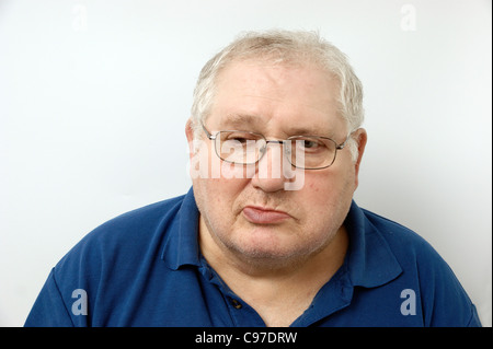 Älterer Mann leidet unter Bell-Lähmung Stockfoto