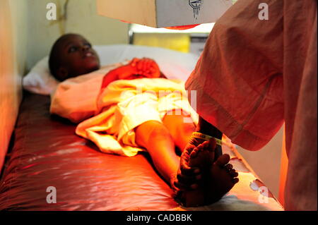 5. August 2010 - Kano, KANO, NIGERIA - Mujahid Abdullahi, 9, weint, als er für seine Beine an Kinderlähmung verkrüppelt Lichtbehandlung erhält. Familien bringen ihre Kinder verkrüppelt durch Kinderlähmung zu den Murtala Mohammed Fachkrankenhaus in Kano, Nigeria, Licht-Behandlung erhalten. Familien zahlen 100 Naira, etwa für Stockfoto