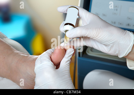 Eine Fußpflegerin bearbeitet die Zehennägel mit Maniküre Öl Stockfoto