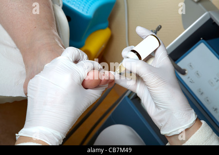 Eine Fußpflegerin bearbeitet die Zehennägel mit Maniküre Öl Stockfoto