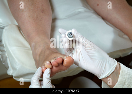 Eine Fußpflegerin bearbeitet die Zehennägel mit Maniküre Öl Stockfoto