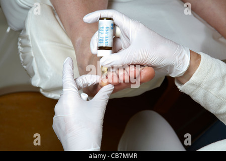 Eine Fußpflegerin bearbeitet die Zehennägel mit Maniküre Öl Stockfoto