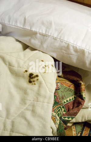 Das Problem der Sauberkeit im Hotelzimmer wird durch getrocknete Blutflecken auf der Tröster in einem Motelzimmer Texas belegt. Stockfoto