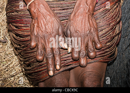 Dani Frauen amputieren Finger, nach Tod des nahen Beziehungen, Baliem-Tal, West-Papua, Indonesien Stockfoto