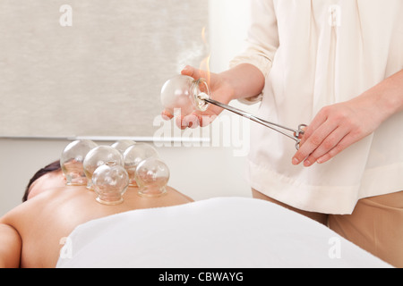 Detail einer Flamme erhitzen ein Feuer Schröpfen Glas Stockfoto