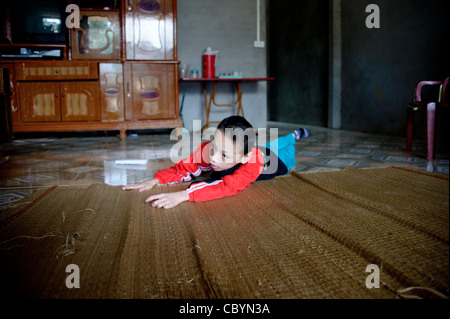 Vietnamesische junge als Cerebralparese (CP) Patienten, das Ergebnis eines Verlustes der Sauerstoff unmittelbar vor / während der Geburt diagnostiziert. Stockfoto