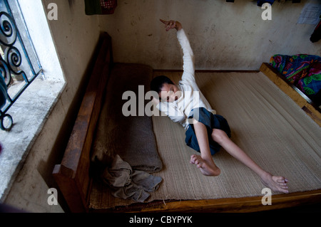 Cerebralparese (CP) Patienten, heranwachsenden Jungen, auf einem Bett im Haus Vietnam. Stockfoto