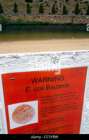 Ein Schild Warnung von E. Coli-Bakterien in der Sandy Point Schwimmen Wasser im Entdeckerpark unter Lucky Peak Dam, Idaho, USA. Stockfoto