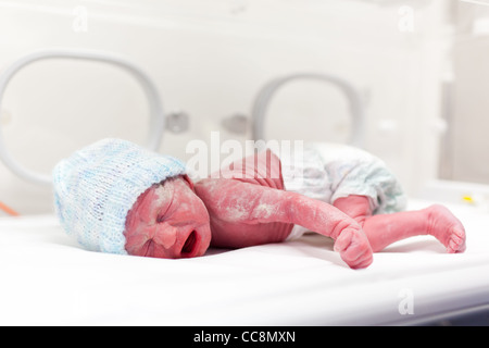 Neugeborenes Baby Boy bedeckt Vertix im Inkubator Stockfoto