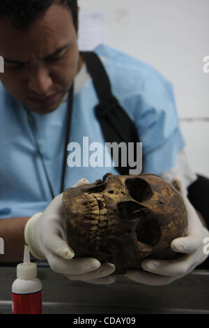 Sep 17, 2010 - Guatemala-Stadt, Guatemala - Knochen mit Zeichen des Traumas sind Sonderbehandlung zuteil, als vorläufige Studien festgestellt, dass die meisten der Opfer des erzwungenen Verschwindens, die schließlich als XX in La Verbena begraben wurden wahrscheinlich zuerst ausgeführt. Daher, wenn ein Knochen zeigt Trauma es Stockfoto