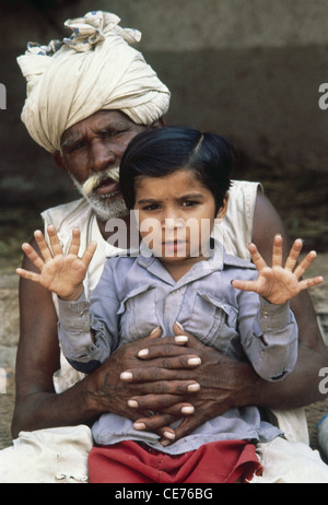 Hexadactyly; Indischer Mann und Enkel mit sechs Fingern in den Händen; angeborene Fehlbildung; polydactyly; polydactylism; hyperdactyly; Indien; Asien Stockfoto