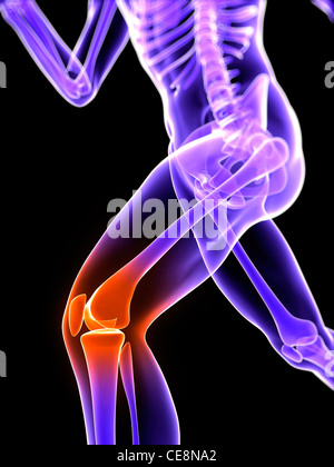 Schmerzen im Knie, konzeptionelle Computer Grafik. Stockfoto