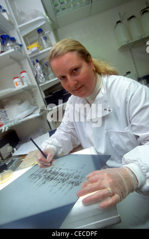 Dr. Marcella Votruba, die Ursache des dominanten Optikusatrophie, Moorfields Eye Hospital entdeckte Stockfoto