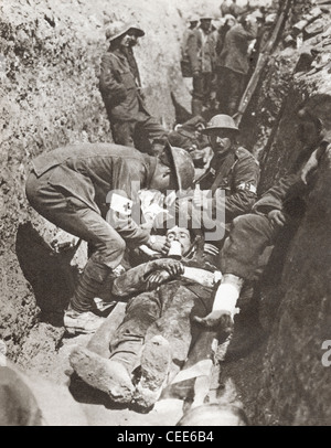 Bahre Träger die Hilfe für ein Soldat auf der Somme, Frankreich im ersten Weltkrieg verwundet in einem Graben liegen. Stockfoto