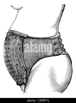 Bauchgurt von Dr. Pinard, graviert Vintage Illustration. Magasin Pittoresque 1875. Stockfoto