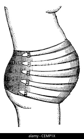 Abdominal-Professor Courty graviert Vintage Illustration. Magasin Pittoresque 1875. Stockfoto