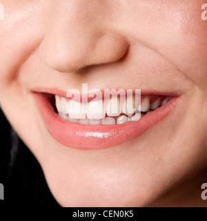 Schöne weiße Zähne in ein perfektes Lächeln ein weibliches Gesicht, Zahnarzt-Zahn-Bleaching-Konzept. Stockfoto