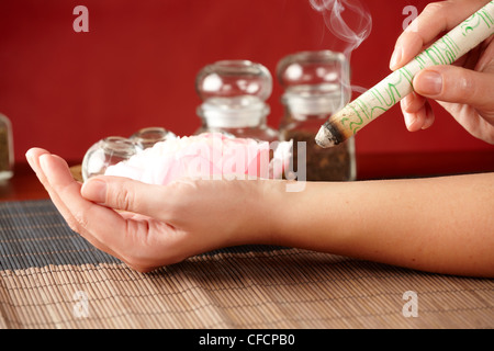 TCM-Traditionelle chinesische Medizin. Hand, die Anwendung von Moxa Stick Therapie, natürlicher Kräutern in Gläsern im Hintergrund Stockfoto