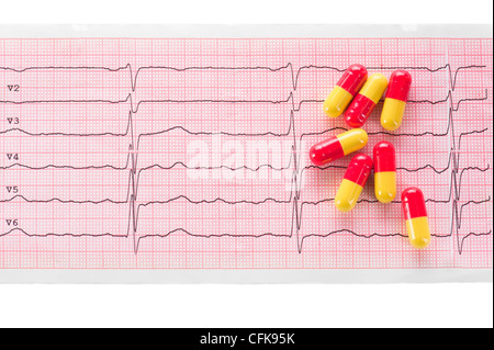 Kardiologie. Makro der ECG Graph und Cardio-Pillen Stockfoto