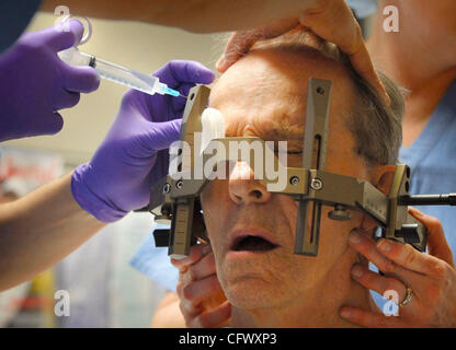 GLEN STUBBE • gstubbe@startribune.com.November 29, 2006--St. Louis Park, Minn--Dr. Richard Veyna injiziert eine Lokalanästhesie durch Schraubenlöcher in einem Stahl Halo, der Richard Bendixs Kopf während der deep Brain Stimulation Operation zur Symptomkontrolle von Bendixs Parkinsons verankern würde.  (Cr Stockfoto