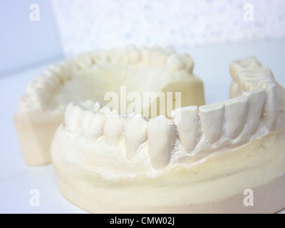 Zwei putzen Zähne, eine obere und eine tiefer, nebeneinander, auf einem Wahite plan Stockfoto