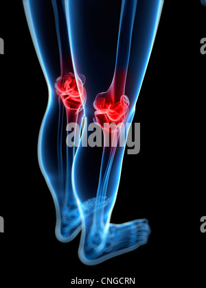 Knie Schmerzen konzeptuellen Kunstwerk Stockfoto