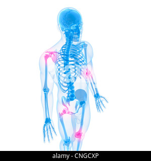 Gelenkschmerzen konzeptuellen Kunstwerk Stockfoto