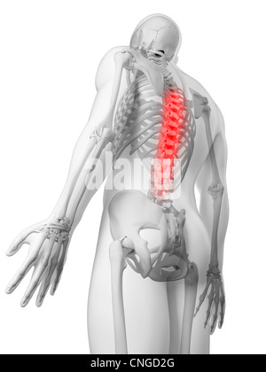 Schmerzen im Rücken konzeptuellen Kunstwerk Stockfoto