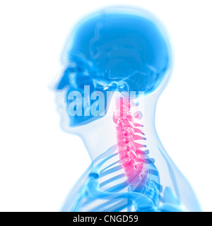Nacken Schmerzen konzeptuellen Kunstwerk Stockfoto