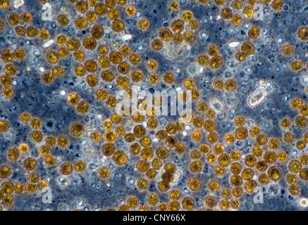 Mikroskopische Foto von symbiotischen Algen (Zooxanthellen) der Gattung Dinoflagellat Symbiodinium (SY: Gymnodinium).  Stichprobe aus einer weichen Korallen (Sinularia Spec.) Stockfoto