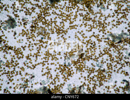 Mikroskopische Foto von symbiotischen Algen (Zooxanthellen) der Gattung Dinoflagellat Symbiodinium (SY: Gymnodinium).  Stichprobe aus einer weichen Korallen (Sinularia sp.) Stockfoto