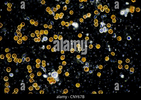 Mikroskopische Foto von symbiotischen Algen (Zooxanthellen) der Gattung Dinoflagellat Symbiodinium (SY: Gymnodinium).  Stichprobe aus einer weichen Korallen (Sinularia sp.) Stockfoto