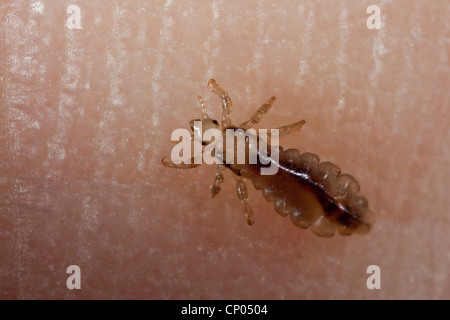 Laus (Pediculus Capitis, Pediculus Humanus Capitis, Pediculus Humanus), die Laus auf der menschlichen Haut, Deutschland Stockfoto