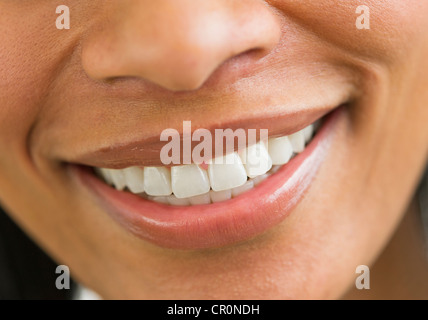 Nahaufnahme des Weibes perfekte Zähne Stockfoto
