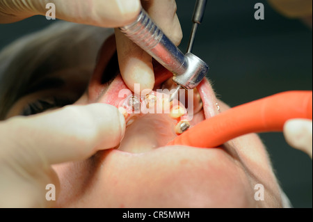 Zahnärztliche Behandlung Stockfoto