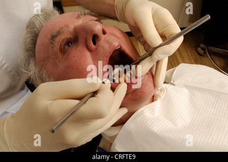 Ein älterer Mann mit seinen Zähnen von seinem Zahnarzt untersucht. Stockfoto